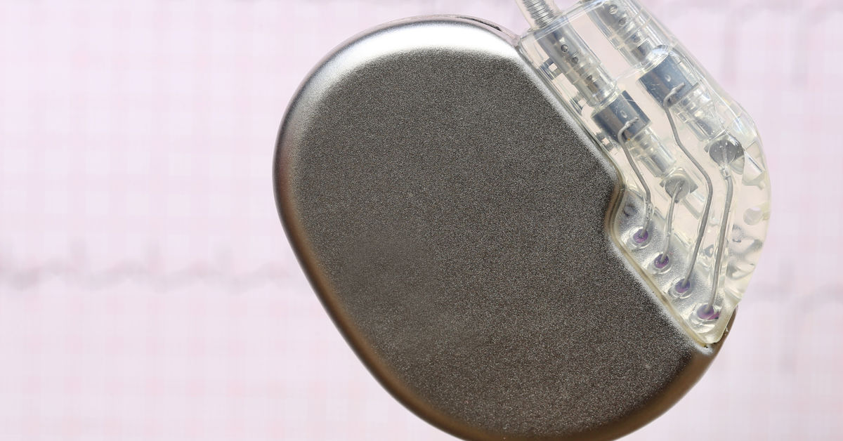 Legge Inn Pacemaker Store geografiske forskjeller i bruk av pacemaker-inngrep - SKDE ...